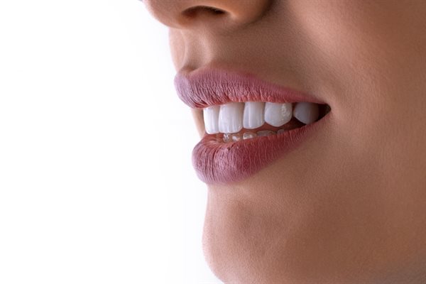 Clareamento Dental